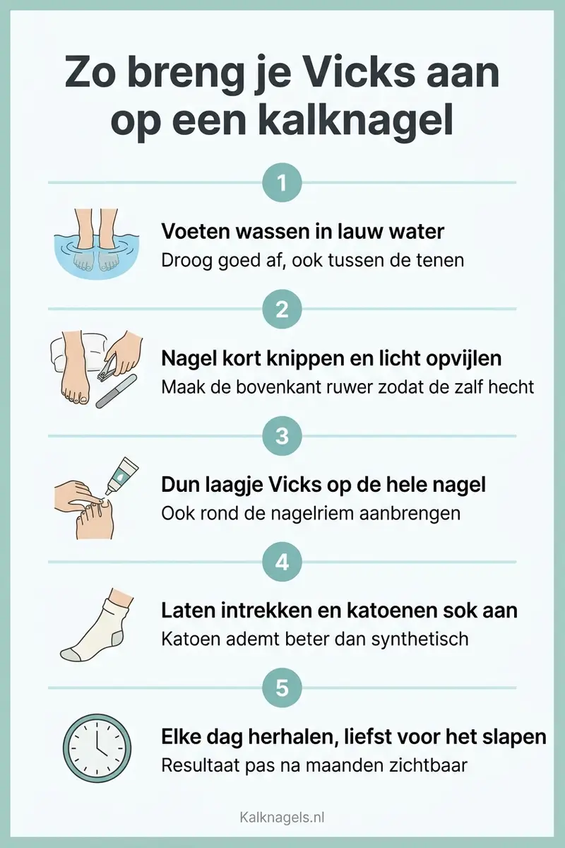 Infographic met een stappenplan voor het aanbrengen van Vicks VapoRub op een kalknagel